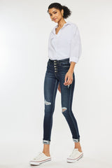 Dark Stone Wash High Rise Button Down Cuffed Ankle Skinny Jeans